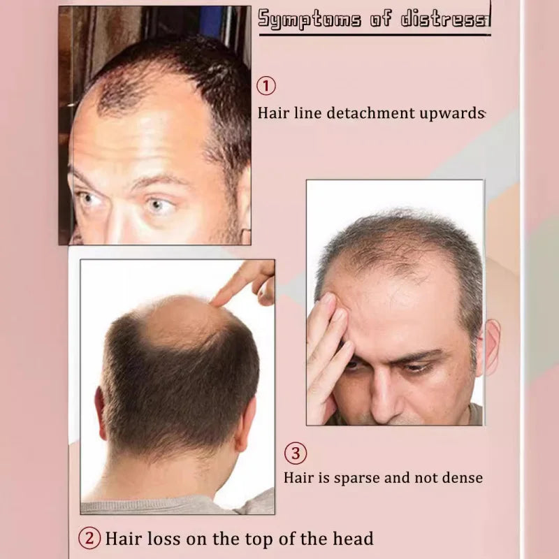 Men's Natural invisibility without any trace breathable straight and wavy Synthetic wig durable hair prosthesis for men